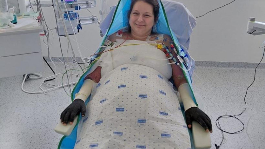 Lavinia Vlad face pași mici în procesul de recuperare după arsuri grave în Belgia
