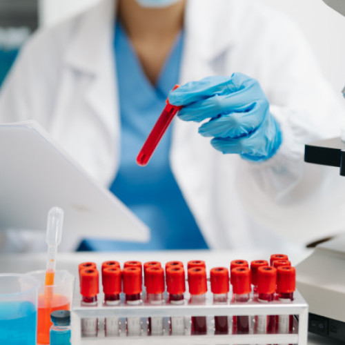 Un nou test de sânge poate detecta cancerul ovarian în stadii incipiente