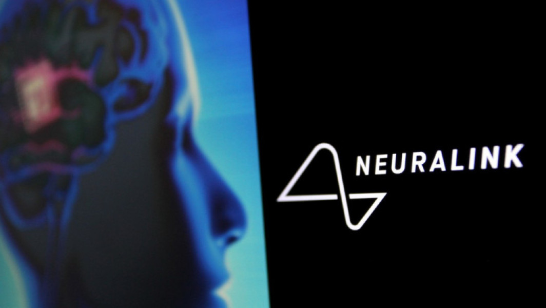 Eșec pentru Elon Musk: Cipul Neuralink se desprinde de creierul unui pacient în prima încercare de implantare